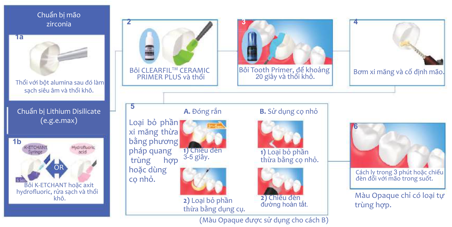Xi măng gắn🌱Veneer và phục hình PANAVIA V5 PASTE Kuraray giá tốt🌱NHA KHOA MALL🌱